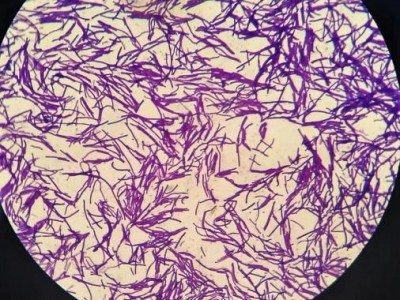 液态肥发酵剂 用于井水腐殖酸钾黄腐酸钾酿造残液过滤后的沼液图5